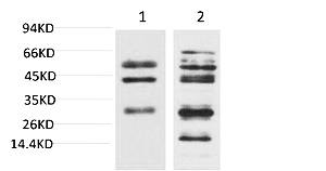 Fig.1. Western blot analysis of 1) Mouse Liver Tissue, 2) Rat Liver Tissue using TGFβ1 Polyclonal Antibody. Secondary antibody (catalog#: A21020) was diluted at 1:20000.