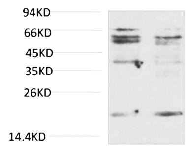Fig.3. Western blot analysis of LPS Treated HepG2 with TNF α Rabbit pAb diluted at 1:2000.