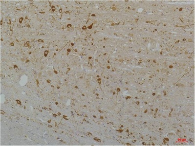 Fig.1. Immunohistochemical analysis of paraffin-embedded Rat Brain Tissue using Cav1.3Rabbit pAb diluted at 1:200.