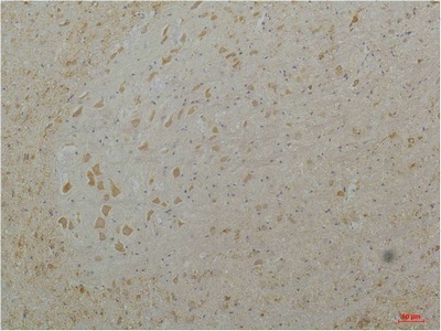 Fig.2. Immunohistochemical analysis of paraffin-embedded Mouse Brain Tissue using Cav1.3Rabbit pAb diluted at 1:200.