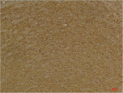Fig.3. Immunohistochemical analysis of paraffin-embedded Mouse BrainTissue using KCNK9 (TASK-3) Rabbit pAb diluted at 1:200.