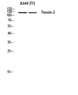 Fig. Western blot analysis of A549 3T3 using Tensin-2 antibody. Antibody was diluted at 1:500. Secondary antibody (catalog#: A21020) was diluted at 1:20000.