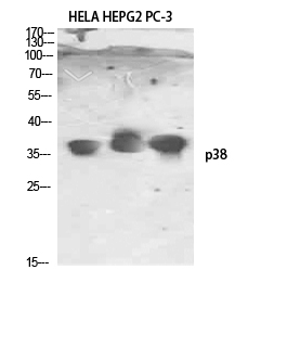 Fig.2. Western Blot analysis of HELA HEPG2 PC-3 using p38 Polyclonal Antibody. Antibody was diluted at 1:1000. Secondary antibody (catalog#: A21020) was diluted at 1:20000.