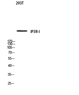 Fig. Western blot analysis of 293T using IP3R-I antibody. Antibody was diluted at 1:500. Secondary antibody (catalog#: A21020) was diluted at 1:20000.