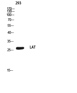 Fig. Western blot analysis of 293 using LAT antibody. Secondary antibody (catalog#: A21020) was diluted at 1:20000.