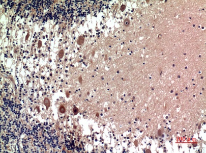 Fig.2. Immunohistochemical analysis of paraffin-embedded human-brain, antibody was diluted at 1:100.