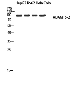 Fig. Western blot analysis of HepG2 K562 Hela Colo using ADAMTS-2 antibody. Secondary antibody (catalog#: A21020) was diluted at 1:20000.