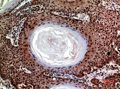 Fig.2. Immunohistochemical analysis of paraffin-embedded human-skin, antibody was diluted at 1:100.