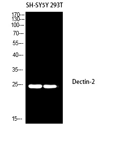 Fig.1. Western blot analysis of SH-SY5Y 293T using Dectin-2 antibody. Antibody was diluted at 1:1000. Secondary antibody (catalog#: A21020) was diluted at 1:20000.