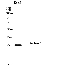 Fig.2. Western blot analysis of K562 using Dectin-2 antibody. Antibody was diluted at 1:1000. Secondary antibody (catalog#: A21020) was diluted at 1:20000.
