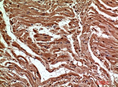 Fig.3. Immunohistochemical analysis of paraffin-embedded human-heart, antibody was diluted at 1:200.