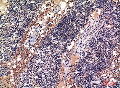 Fig.2. Immunohistochemical analysis of paraffin-embedded human-lymph, antibody was diluted at 1:100.
