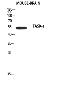 Fig. Western blot analysis of Mouse-brain using TASK-1 antibody. Antibody was diluted at 1:500. Secondary antibody (catalog#: A21020) was diluted at 1:20000.