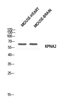 Fig. Western blot analysis of Mouse-HEART Mouse-BRAIN using KPNA2 antibody. Antibody was diluted at 1:500. Secondary antibody (catalog#: A21020) was diluted at 1:20000.