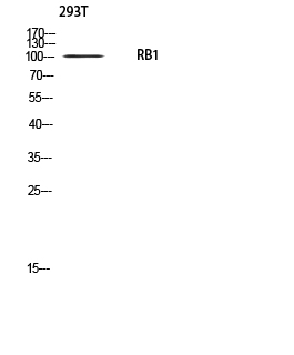 Fig. Western blot analysis of 293T using RB1 antibody. Antibody was diluted at 1:500. Secondary antibody (catalog#: A21020) was diluted at 1:20000.