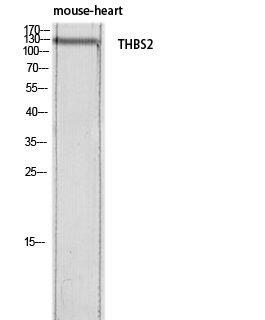 Fig.1. Western blot analysis of Mouse-heart lysis using THBS2 antibody. Antibody was diluted at 1:500. Secondary antibody (catalog#: A21020) was diluted at 1:20000.