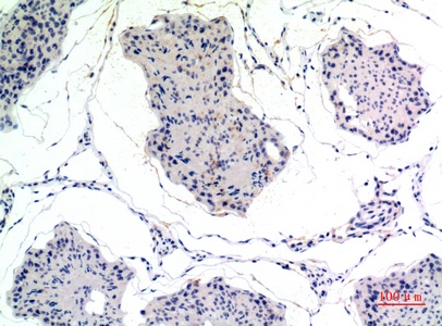 Fig.2. Immunohistochemical analysis of paraffin-embedded rat-testis, antibody was diluted at 1:100.
