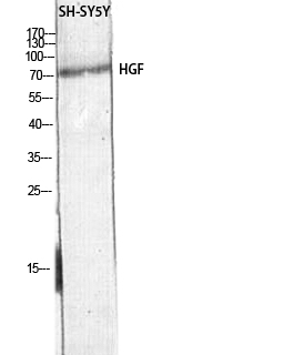 Fig. Western blot analysis of SH-SY5Y lysis using HGF antibody. Antibody was diluted at 1:500. Secondary antibody (catalog#: A21020) was diluted at 1:20000.