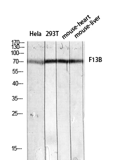 Fig.1. Western blot analysis of varias lysis using F13B antibody. Antibody was diluted at 1:2000. Secondary antibody (catalog#: A21020) was diluted at 1:20000.