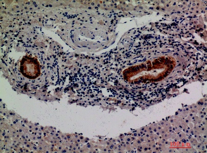Fig.2. Immunohistochemical analysis of paraffin-embedded human-liver, antibody was diluted at 1:200.