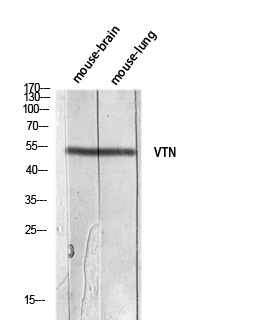 Fig. Western blot analysis of Mouse-brain Mouse-lung lysis using VTN antibody. Antibody was diluted at 1:1000. Secondary antibody (catalog#: A21020) was diluted at 1:20000.