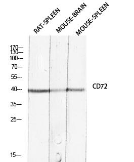 Fig.1. Western blot analysis of RAT-SPLEEN Mouse-BRAIN Mouse-SPLEEN lysis using CD72 antibody. Antibody was diluted at 1:2000. Secondary antibody (catalog#: A21020) was diluted at 1:20000.