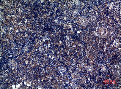 Fig.2. Immunohistochemical analysis of paraffin-embedded human-tonsils, antibody was diluted at 1:100.