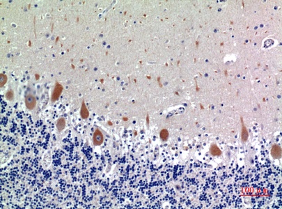 Fig.2. Immunohistochemical analysis of paraffin-embedded human-brain, antibody was diluted at 1:100.