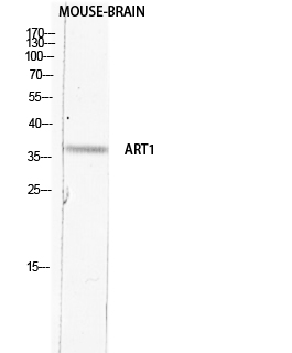 Fig.1. Western blot analysis of Mouse-BRAIN lysis using ART1 antibody. Antibody was diluted at 1:2000. Secondary antibody (catalog#: A21020) was diluted at 1:20000.