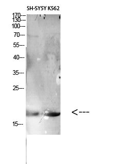 Fig.2. Western Blot analysis of various cells using Antibody diluted at 1:1000. Secondary antibody (catalog#: A21020) was diluted at 1:20000.