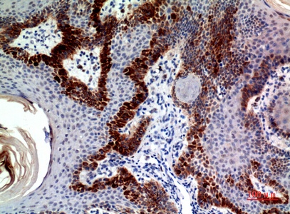 Fig.2. Immunohistochemical analysis of paraffin-embedded human-skin, antibody was diluted at 1:100.