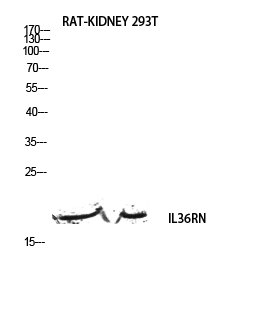 Fig. Western blot analysis of RAT-KIDNEY 293T lysis using IL36RN antibody. Antibody was diluted at 1:500. Secondary antibody (catalog#: A21020) was diluted at 1:20000.