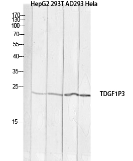 Fig. Western blot analysis of HepG2 293T AD293 Hela lysis using TDGF1P3 antibody. Antibody was diluted at 1:1000. Secondary antibody (catalog#: A21020) was diluted at 1:20000.