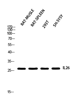 Fig. Western blot analysis of RAT-MUSLE RAT-SPLEEN 293T SH-SY5Y using IL26 antibody. Antibody was diluted at 1:2000. Secondary antibody (catalog#: A21020) was diluted at 1:20000.