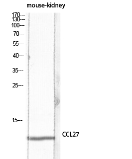 Fig.1. Western blot analysis of Mouse-kidney lysis using CCL27 antibody. Antibody was diluted at 1:1000. Secondary antibody (catalog#: A21020) was diluted at 1:20000.