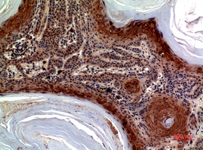 Fig.2. Immunohistochemical analysis of paraffin-embedded human-skin, antibody was diluted at 1:100.