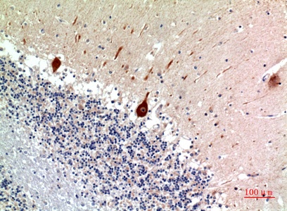 Fig.2. Immunohistochemical analysis of paraffin-embedded human-brain, antibody was diluted at 1:100.