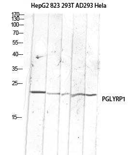 Fig. Western blot analysis of HepG2 823-AV 293T AD293 Hela lysis using PGLYRP1 antibody. Antibody was diluted at 1:1000. Secondary antibody (catalog#: A21020) was diluted at 1:20000.