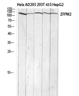 Fig.1. Western blot analysis of Hela AD293 293T 453 HepG2 lysis using ZFPM2 antibody. Antibody was diluted at 1:1000. Secondary antibody (catalog#: A21020) was diluted at 1:20000.