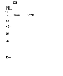 Fig.2. Western blot analysis of 823 using SYN1 antibody. Antibody was diluted at 1:1000. Secondary antibody (catalog#: A21020) was diluted at 1:20000.