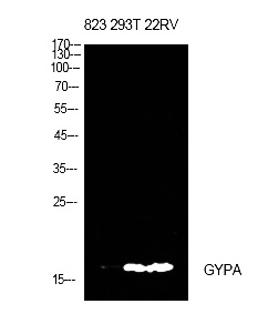 Fig.1. Western Blot analysis of 823, 293T, 22RV cells using CD235a Polyclonal Antibody. Antibody was diluted at 1:500. Secondary antibody (catalog#: A21020) was diluted at 1:20000.