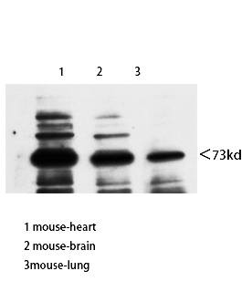 Fig.4. Western Blot analysis of Mouse-heart Mouse-brain Mouse-lung using Neuregulin-3 Polyclonal Antibody diluted at 1:800. Secondary antibody (catalog#: A21020) was diluted at 1:20000.