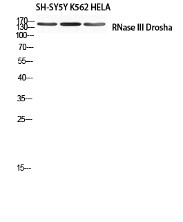 Fig.1. Western blot analysis of SH-SY5Y K562 HELA using RNase III Drosha antibody. Antibody was diluted at 1:1000. Secondary antibody (catalog#: A21020) was diluted at 1:20000.