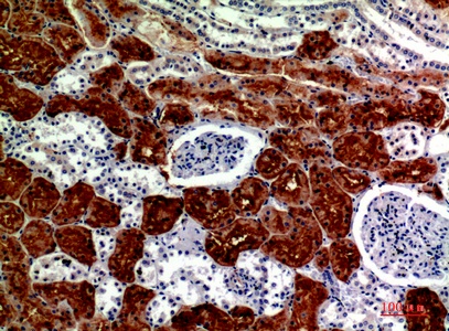 Fig.3. Immunohistochemical analysis of paraffin-embedded human-kidney, antibody was diluted at 1:200.