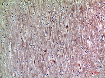 Fig.2. Immunohistochemical analysis of paraffin-embedded human-brain, antibody was diluted at 1:200.