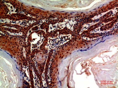 Fig.3. Immunohistochemical analysis of paraffin-embedded human-skin, antibody was diluted at 1:200.