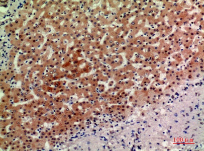 Fig.4. Immunohistochemical analysis of paraffin-embedded human-liver, antibody was diluted at 1:200.