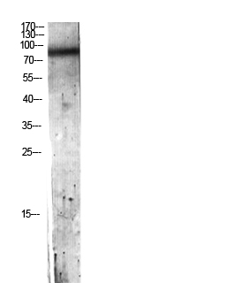Fig.1. Western blot analysis of Hela lysis using C7 antibody. Antibody was diluted at 1:500. Secondary antibody (catalog#: A21020) was diluted at 1:20000.