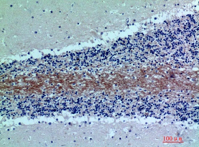 Fig.2. Immunohistochemical analysis of paraffin-embedded human-brain, antibody was diluted at 1:200.