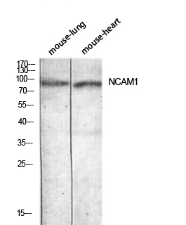 Fig.1. Western blot analysis of Mouse-lung Mouse-heart lysis using NCAM1 antibody. Antibody was diluted at 1:1000. Secondary antibody (catalog#: A21020) was diluted at 1:20000.